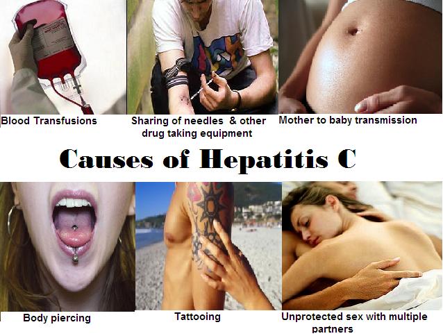 Poster demonstrating Hepatitis C causes